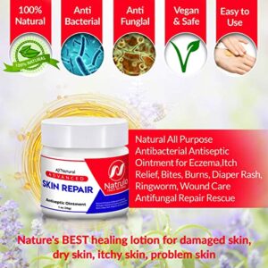 Skin Anti-itch Cream Herbal Antiseptic Salve Antibiotic  Anti-Inflammation For Dermatitis Eczema And More Skin Itching Relief