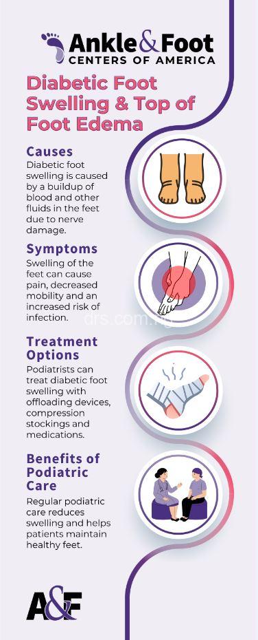Does Diabetes Cause Swollen Ankles? Things You Should Know!